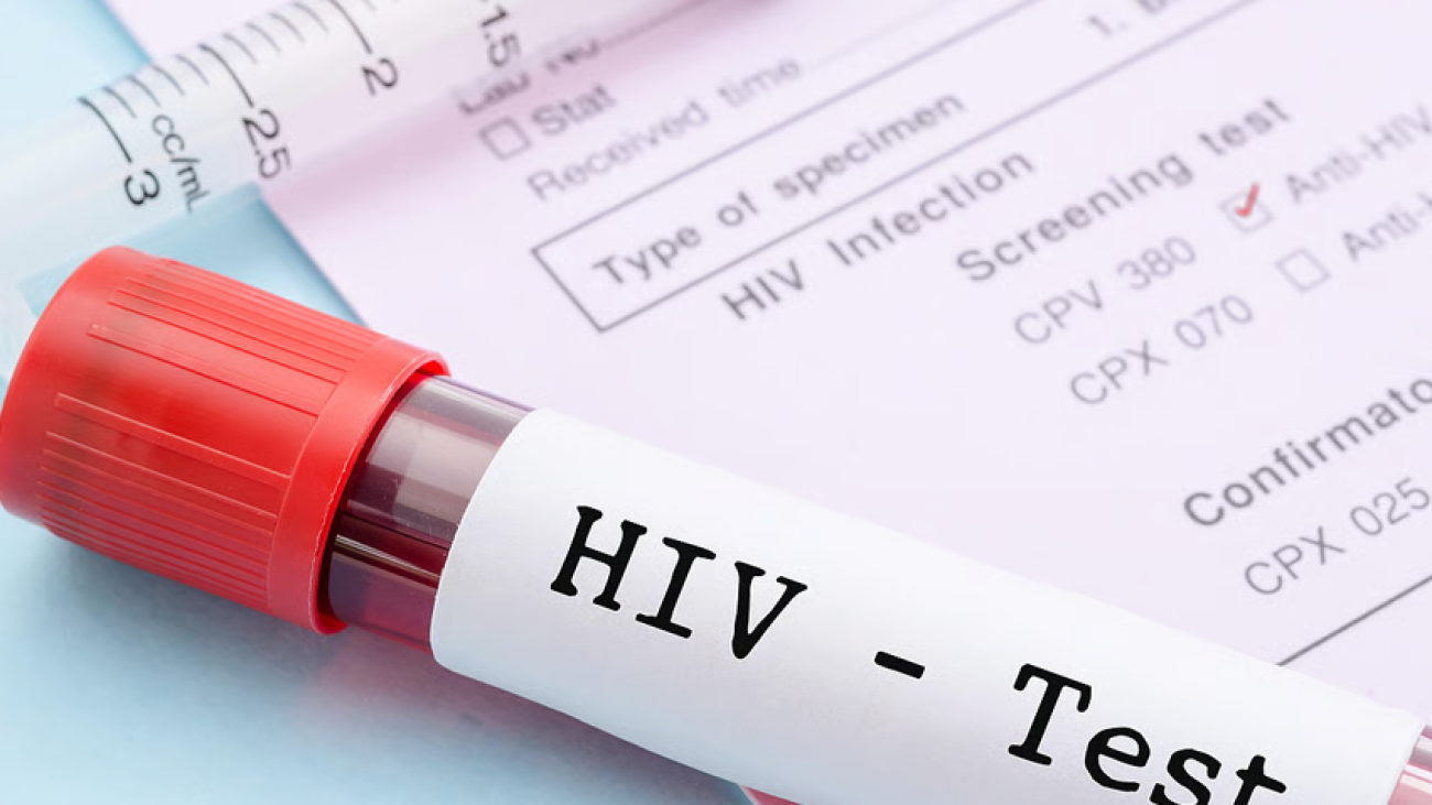 HIV